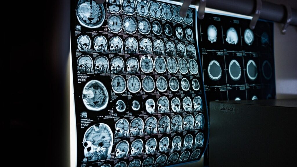 Checkliste Neurologie kostenlos als PDF herunterladen